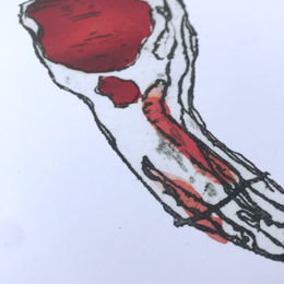'Svinekoteletten'-tryk A5