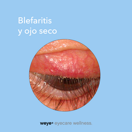 Gel Weye