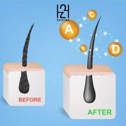Siero anticaduta 3D BIO-BOOST