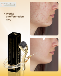 Derma rulle 0,5 MM