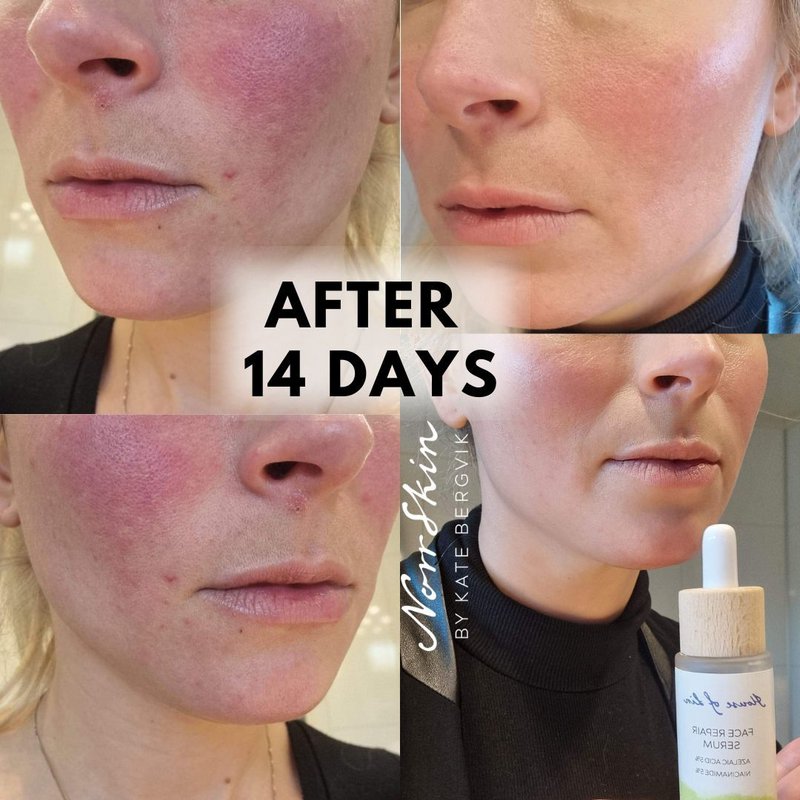 Norrskin - Natural and Eco skincare from Sweden - 3